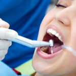 wisdom teeth treatment and guide brampton