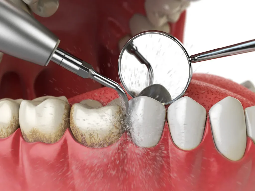 dental-exam-near-me