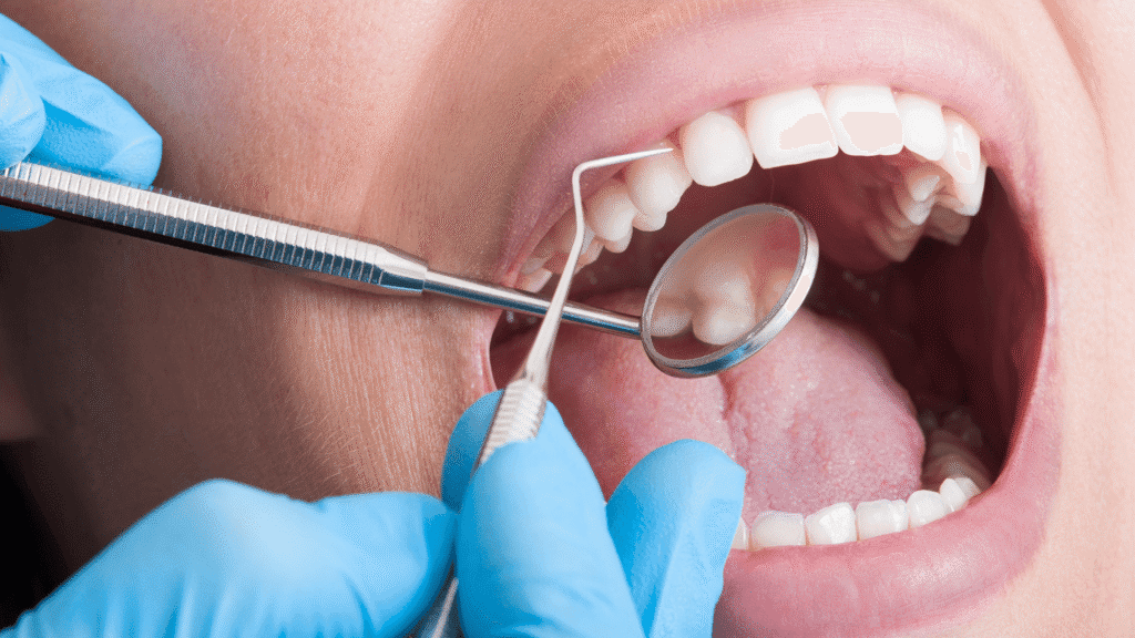 dental-exam-brampton