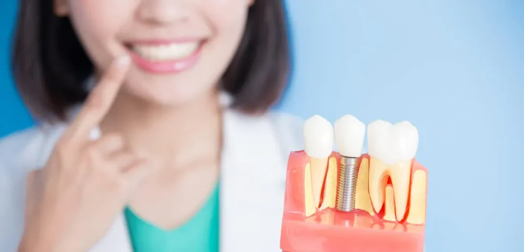 Dental professional holding a model of teeth and an implant