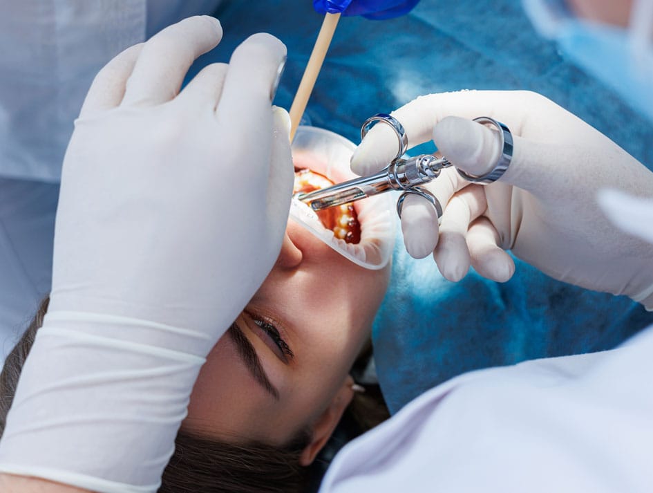 Bone grafting procedure for dental implant placement