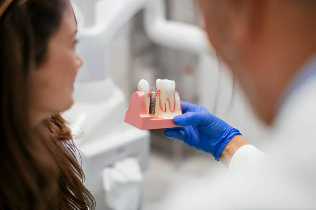 Model showing single tooth implants in Brampton with a post and replacement crown